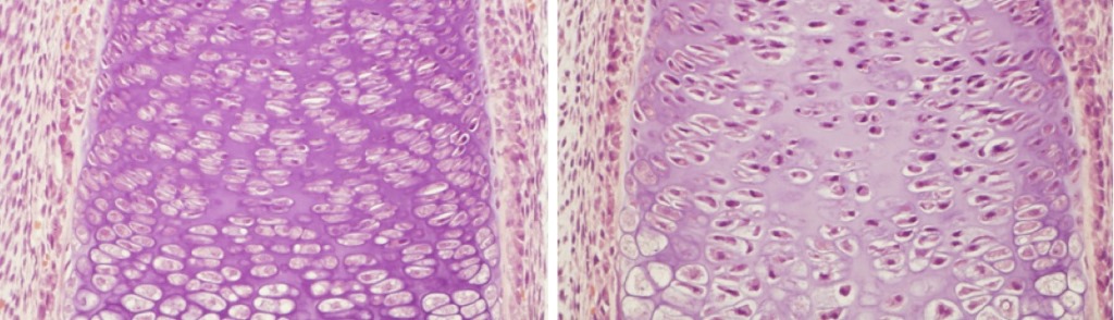 תאי סחוס בעצם המתפתחת (משמאל). כאשר פוגעים בביטוי הגן HIF-1α קטן מספר התאים באזור הדל בחמצן, והרקמה התומכת שלהם מצטמצמת (מימין)